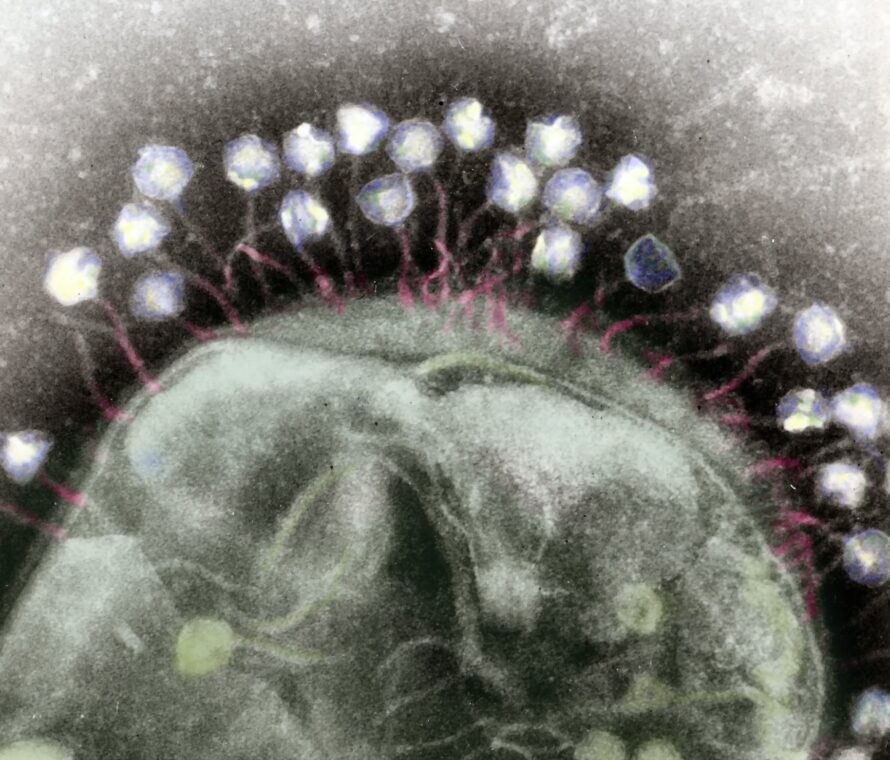 A false-color transmission electron micrograph of multiple bacteriophages attached to a bacterial cell wall.