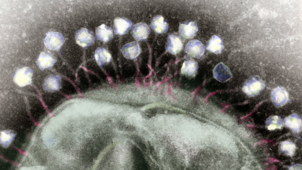 This colorized transmission electron micrograph shows numerous phages attached to a bacterial cell wall. Phages are known for their unique structures, which resemble a cross between NASA’s Apollo lunar lander and an arthropod.